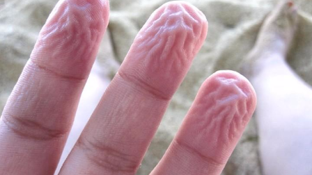 手指头像是泡水了一样皱